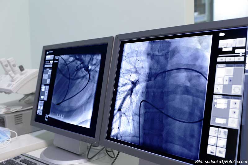 Deutliche Unterschiede bei Ärztedichte in Deutschland